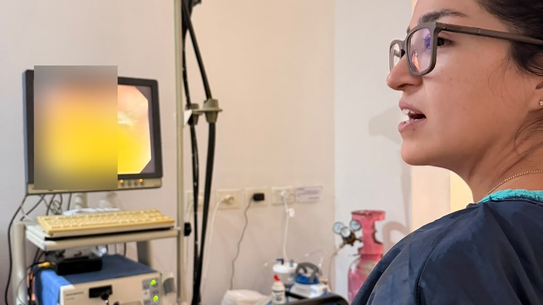Estudio endoscópico con tecnología HD en CIG